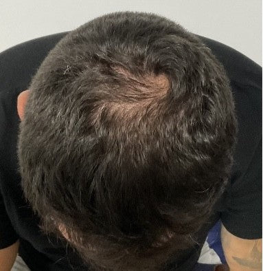 After image