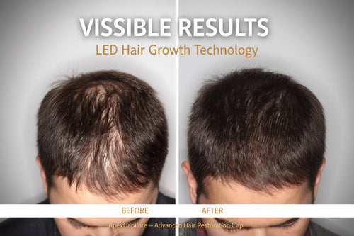Confidence-Boosting Hair Growth Cap